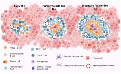 Mature tertiary lymphoid structures: important contributors to anti-tumor immune efficacy